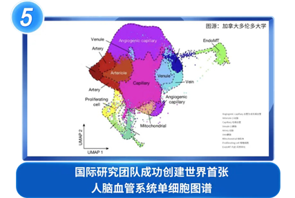 国际研究团队成功创建世界首张人脑血管系统单细胞图谱