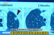 【新闻直播间】2018年诺贝尔生理学或医学奖揭晓：美日科学家分享生理学或医学奖